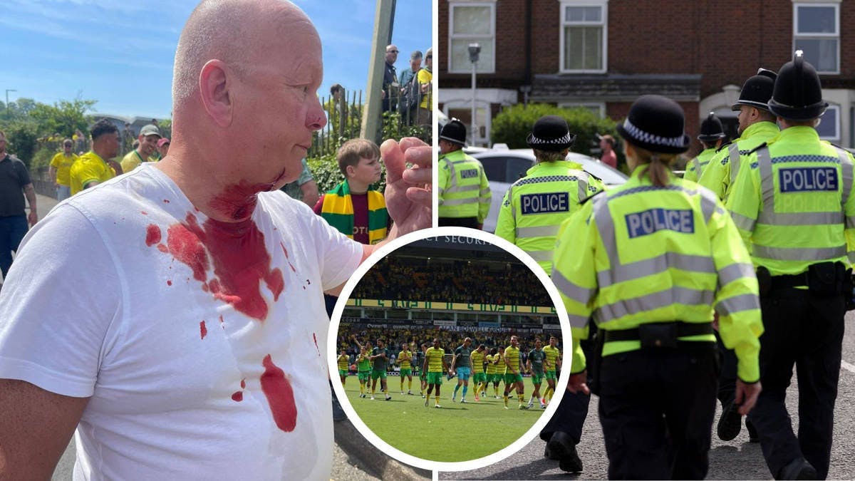 Leeds Fan Slashed in Neck After Championship Semi-Final Draw at Norwich, Two Arrested